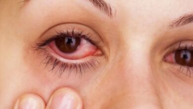 Ubati sakit mata tanpa gunakan ubat