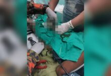 Bomba bantu tanggalkan cincin sangkut pada kemaluan