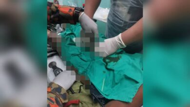 Bomba bantu tanggalkan cincin sangkut pada kemaluan