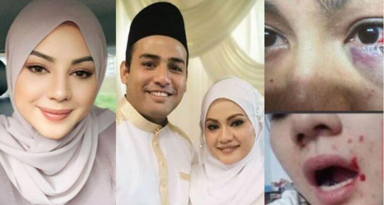 Isteri Afiq Anggap Tindakan Memaafkan Suami Umpama Bunuh Diri