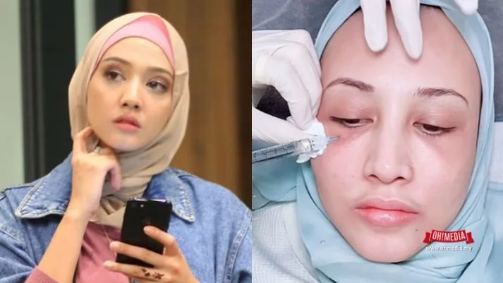 Muka Fatiya Latif Nampak Makin Pelik