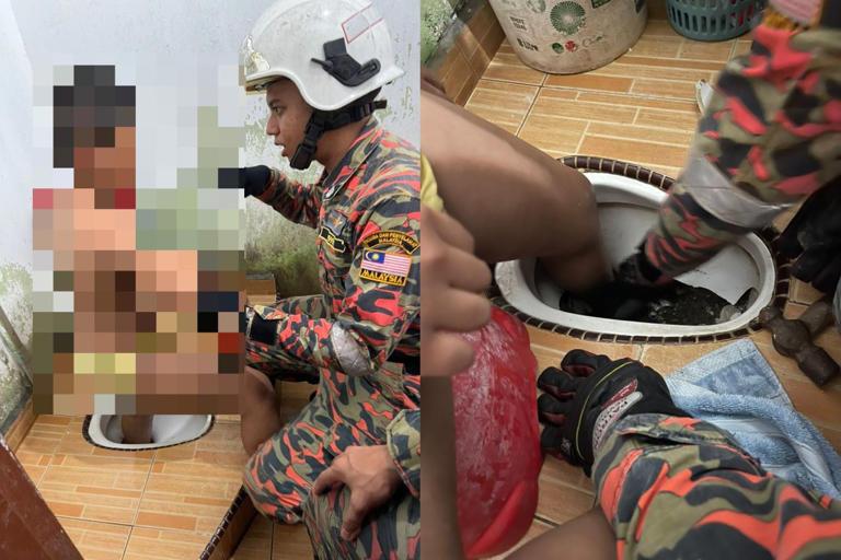 Bomba breaks toilet to free boy’s leg