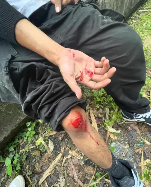 Zynakal Kemalangan Jalan Raya Ketika Konvoi Motosikal Kuasa Tinggi