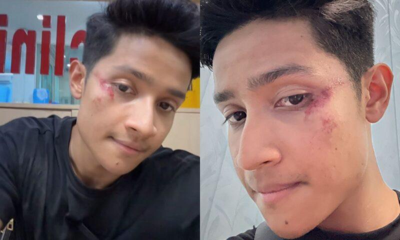 Afieq Shazwan kemalangan di Krabi