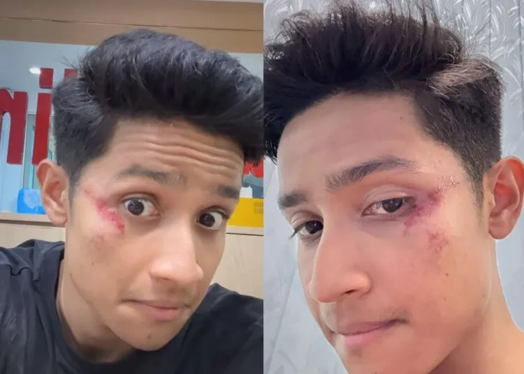 Afieq Shazwan: Kemalangan Ketika Bercuti Di Krabi