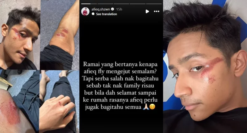 Afieq Shazwan: Kemalangan Ketika Bercuti Di Krabi