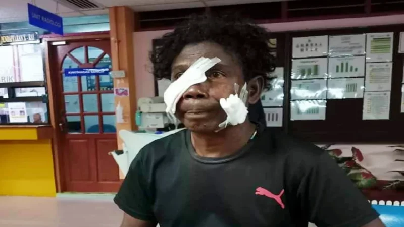 Orang Asli cedera diserang harimau